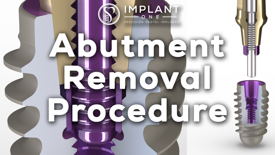 Abutment Removal Procedure, Animated