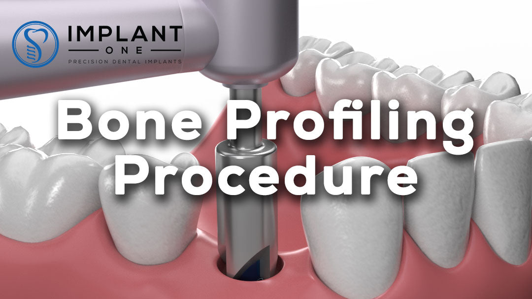 Bone Profiling Procedure, Animated