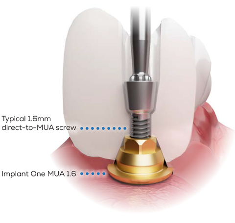 Implant One MUA 1.6 IFU