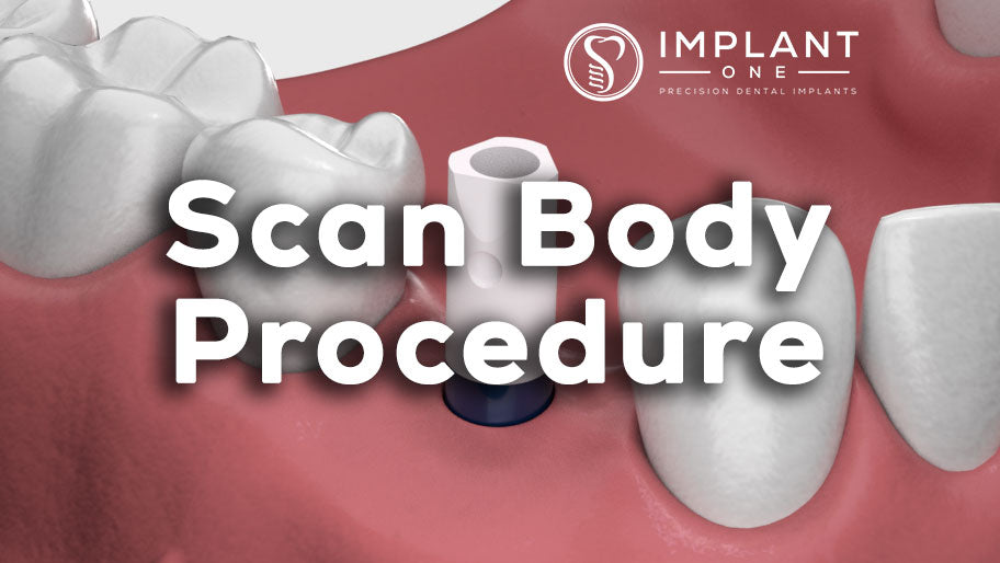 Scan Body Procedure, Animated