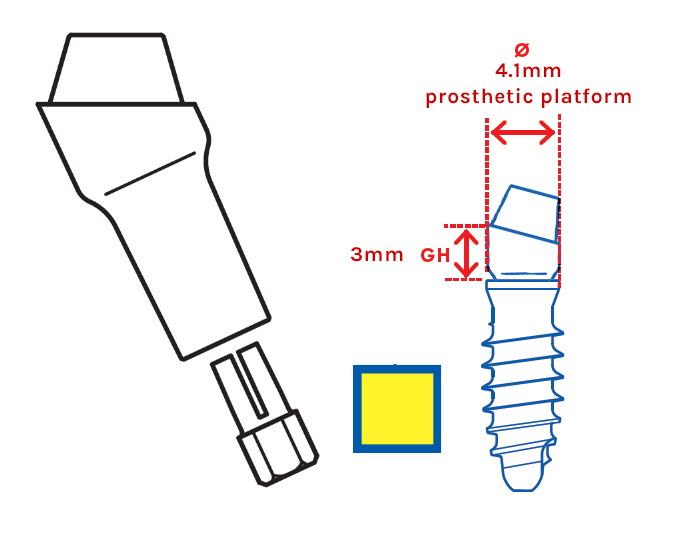 Leone MUA Abutment, Yellow